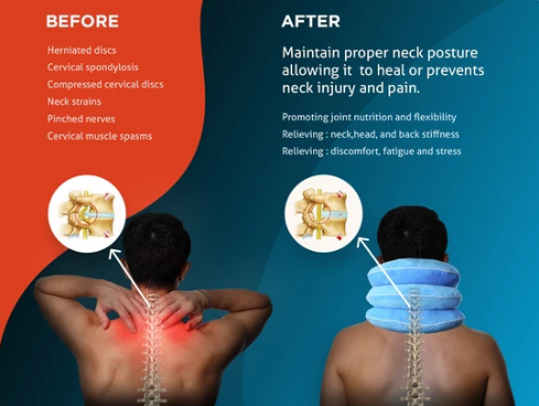 Use Cervical Neck Traction Device to Handle Chronic Neck Pain